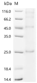 (Tris-Glycine gel) Discontinuous SDS-PAGE (reduced) with 5% enrichment gel and 15% separation gel.