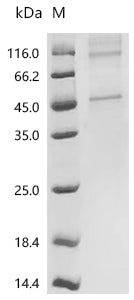 (Tris-Glycine gel) Discontinuous SDS-PAGE (reduced) with 5% enrichment gel and 15% separation gel.