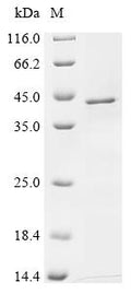 (Tris-Glycine gel) Discontinuous SDS-PAGE (reduced) with 5% enrichment gel and 15% separation gel.