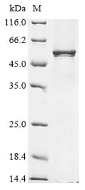 (Tris-Glycine gel) Discontinuous SDS-PAGE (reduced) with 5% enrichment gel and 15% separation gel.
