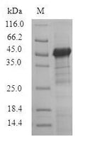 (Tris-Glycine gel) Discontinuous SDS-PAGE (reduced) with 5% enrichment gel and 15% separation gel.