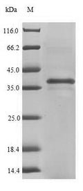 (Tris-Glycine gel) Discontinuous SDS-PAGE (reduced) with 5% enrichment gel and 15% separation gel.