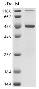 (Tris-Glycine gel) Discontinuous SDS-PAGE (reduced) with 5% enrichment gel and 15% separation gel.