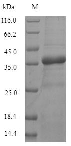 (Tris-Glycine gel) Discontinuous SDS-PAGE (reduced) with 5% enrichment gel and 15% separation gel.