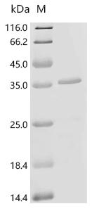 (Tris-Glycine gel) Discontinuous SDS-PAGE (reduced) with 5% enrichment gel and 15% separation gel.