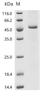 (Tris-Glycine gel) Discontinuous SDS-PAGE (reduced) with 5% enrichment gel and 15% separation gel.