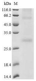 (Tris-Glycine gel) Discontinuous SDS-PAGE (reduced) with 5% enrichment gel and 15% separation gel.