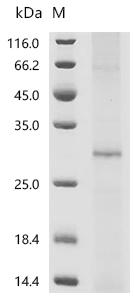 (Tris-Glycine gel) Discontinuous SDS-PAGE (reduced) with 5% enrichment gel and 15% separation gel.
