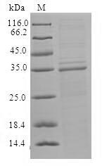 (Tris-Glycine gel) Discontinuous SDS-PAGE (reduced) with 5% enrichment gel and 15% separation gel.