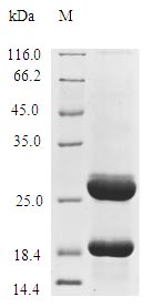 (Tris-Glycine gel) Discontinuous SDS-PAGE (reduced) with 5% enrichment gel and 15% separation gel.