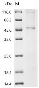 (Tris-Glycine gel) Discontinuous SDS-PAGE (reduced) with 5% enrichment gel and 15% separation gel.