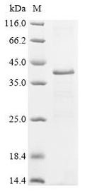 (Tris-Glycine gel) Discontinuous SDS-PAGE (reduced) with 5% enrichment gel and 15% separation gel.