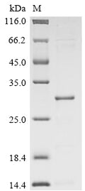 (Tris-Glycine gel) Discontinuous SDS-PAGE (reduced) with 5% enrichment gel and 15% separation gel.