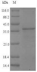 (Tris-Glycine gel) Discontinuous SDS-PAGE (reduced) with 5% enrichment gel and 15% separation gel.