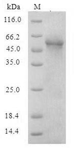 (Tris-Glycine gel) Discontinuous SDS-PAGE (reduced) with 5% enrichment gel and 15% separation gel.