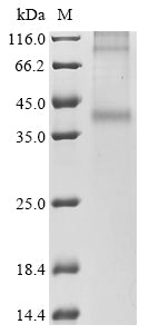 (Tris-Glycine gel) Discontinuous SDS-PAGE (reduced) with 5% enrichment gel and 15% separation gel.