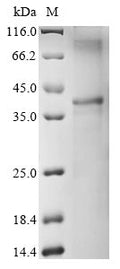 (Tris-Glycine gel) Discontinuous SDS-PAGE (reduced) with 5% enrichment gel and 15% separation gel.