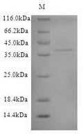 (Tris-Glycine gel) Discontinuous SDS-PAGE (reduced) with 5% enrichment gel and 15% separation gel.