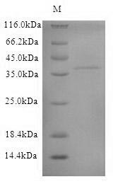 (Tris-Glycine gel) Discontinuous SDS-PAGE (reduced) with 5% enrichment gel and 15% separation gel.