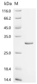 (Tris-Glycine gel) Discontinuous SDS-PAGE (reduced) with 5% enrichment gel and 15% separation gel.