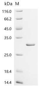 (Tris-Glycine gel) Discontinuous SDS-PAGE (reduced) with 5% enrichment gel and 15% separation gel.