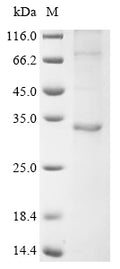 (Tris-Glycine gel) Discontinuous SDS-PAGE (reduced) with 5% enrichment gel and 15% separation gel.