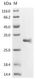 (Tris-Glycine gel) Discontinuous SDS-PAGE (reduced) with 5% enrichment gel and 15% separation gel.