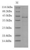 (Tris-Glycine gel) Discontinuous SDS-PAGE (reduced) with 5% enrichment gel and 15% separation gel.
