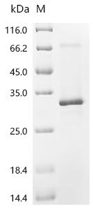 (Tris-Glycine gel) Discontinuous SDS-PAGE (reduced) with 5% enrichment gel and 15% separation gel.