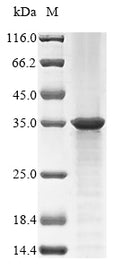 (Tris-Glycine gel) Discontinuous SDS-PAGE (reduced) with 5% enrichment gel and 15% separation gel.