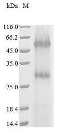 (Tris-Glycine gel) Discontinuous SDS-PAGE (reduced) with 5% enrichment gel and 15% separation gel.