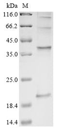 (Tris-Glycine gel) Discontinuous SDS-PAGE (reduced) with 5% enrichment gel and 15% separation gel.