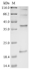 (Tris-Glycine gel) Discontinuous SDS-PAGE (reduced) with 5% enrichment gel and 15% separation gel.