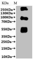 (Tris-Glycine gel) Discontinuous SDS-PAGE (reduced) with 5% enrichment gel and 15% separation gel.
