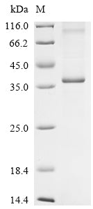 (Tris-Glycine gel) Discontinuous SDS-PAGE (reduced) with 5% enrichment gel and 15% separation gel.