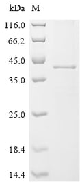 (Tris-Glycine gel) Discontinuous SDS-PAGE (reduced) with 5% enrichment gel and 15% separation gel.