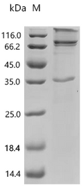 (Tris-Glycine gel) Discontinuous SDS-PAGE (reduced) with 5% enrichment gel and 15% separation gel.