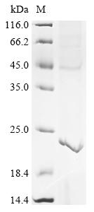 (Tris-Glycine gel) Discontinuous SDS-PAGE (reduced) with 5% enrichment gel and 15% separation gel.