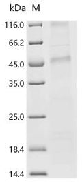 (Tris-Glycine gel) Discontinuous SDS-PAGE (reduced) with 5% enrichment gel and 15% separation gel.