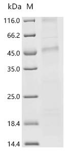 (Tris-Glycine gel) Discontinuous SDS-PAGE (reduced) with 5% enrichment gel and 15% separation gel.