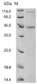 (Tris-Glycine gel) Discontinuous SDS-PAGE (reduced) with 5% enrichment gel and 15% separation gel.