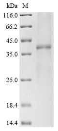 (Tris-Glycine gel) Discontinuous SDS-PAGE (reduced) with 5% enrichment gel and 15% separation gel.
