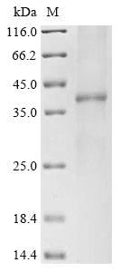 (Tris-Glycine gel) Discontinuous SDS-PAGE (reduced) with 5% enrichment gel and 15% separation gel.