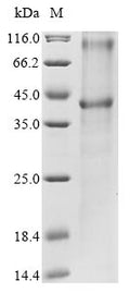 (Tris-Glycine gel) Discontinuous SDS-PAGE (reduced) with 5% enrichment gel and 15% separation gel.