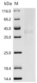 (Tris-Glycine gel) Discontinuous SDS-PAGE (reduced) with 5% enrichment gel and 15% separation gel.