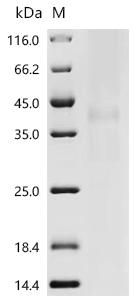 (Tris-Glycine gel) Discontinuous SDS-PAGE (reduced) with 5% enrichment gel and 15% separation gel.