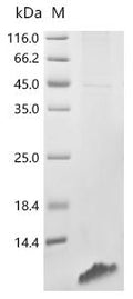 (Tris-Glycine gel) Discontinuous SDS-PAGE (reduced) with 5% enrichment gel and 15% separation gel.