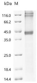 (Tris-Glycine gel) Discontinuous SDS-PAGE (reduced) with 5% enrichment gel and 15% separation gel.