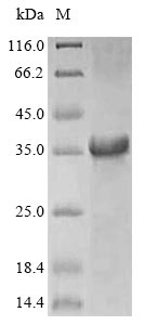 (Tris-Glycine gel) Discontinuous SDS-PAGE (reduced) with 5% enrichment gel and 15% separation gel.
