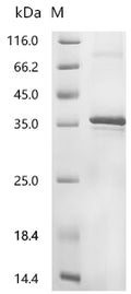 (Tris-Glycine gel) Discontinuous SDS-PAGE (reduced) with 5% enrichment gel and 15% separation gel.